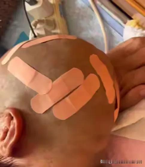 天津，67岁大爷花10块钱在理发店剃头，结果被理发师弄的一脑袋伤口，大爷没不好意