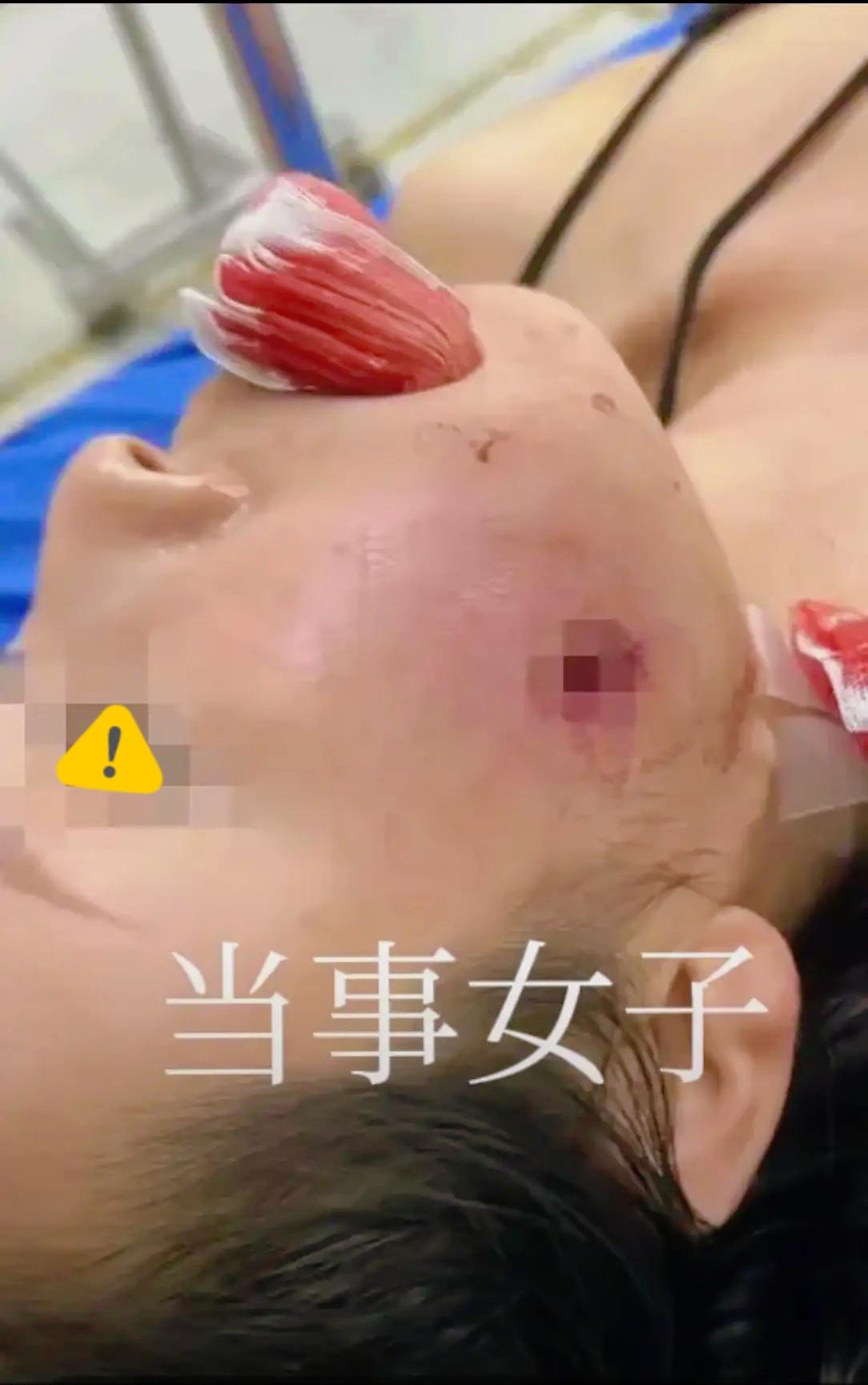 真的越想越后怕！
中国母女去泰国普吉岛旅游，
就想在射击场拍张照，竟被
流弹击穿