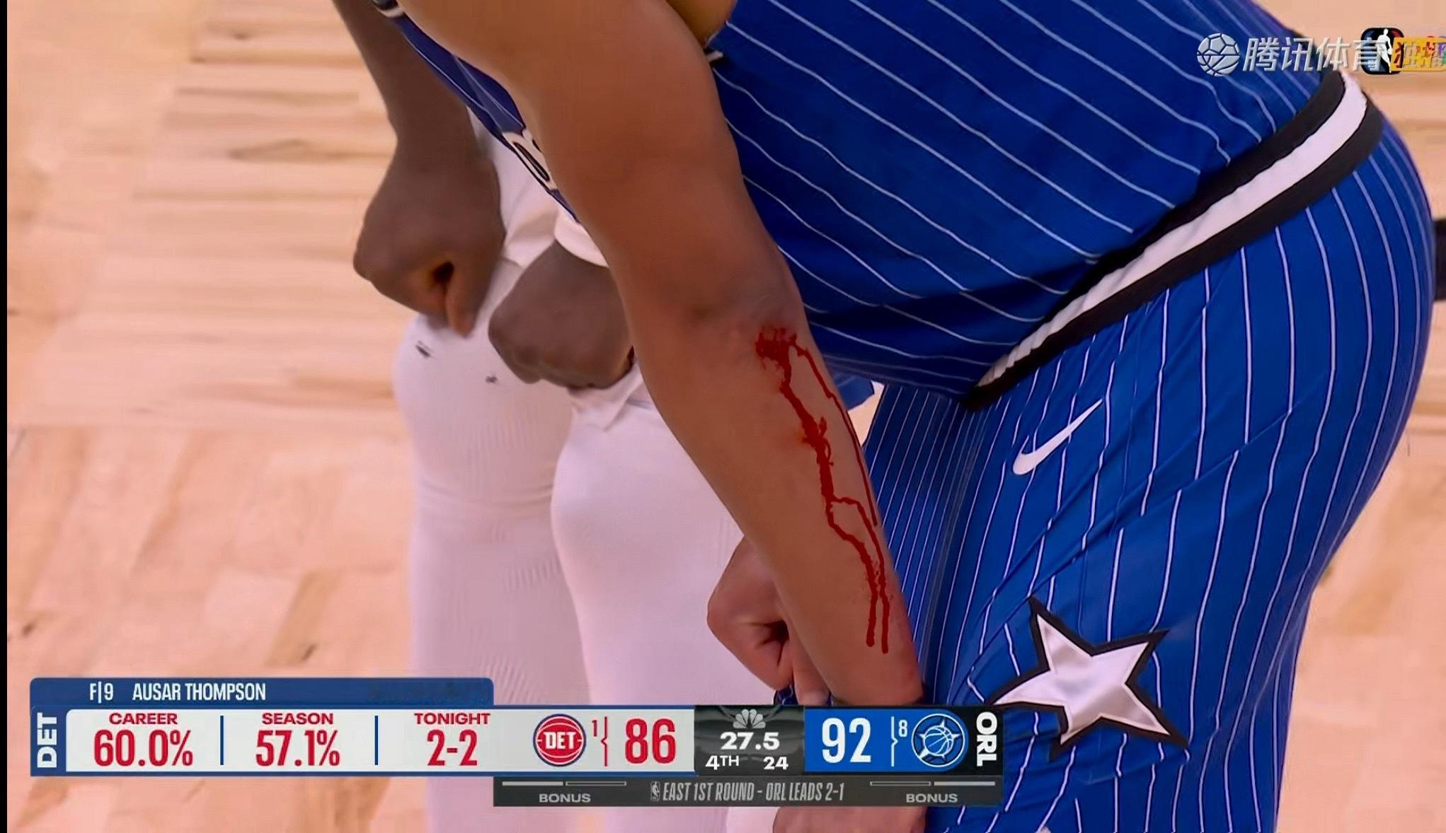 贝恩5个三分血战活塞！得到22分5板！ 