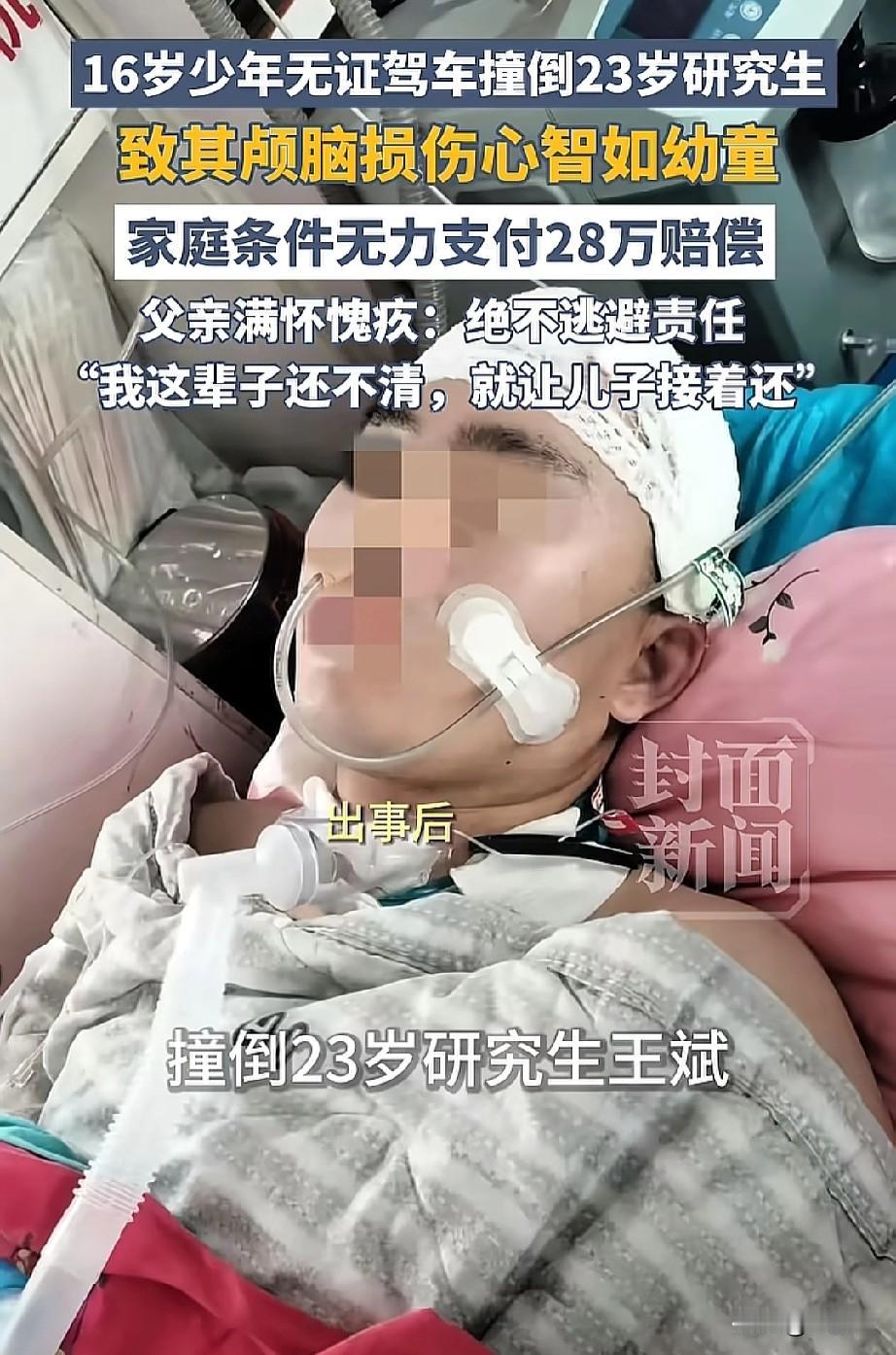 太痛心了！23岁研究生被16岁少年无证驾驶给撞倒，至其脑损伤，心智如幼童一样，而