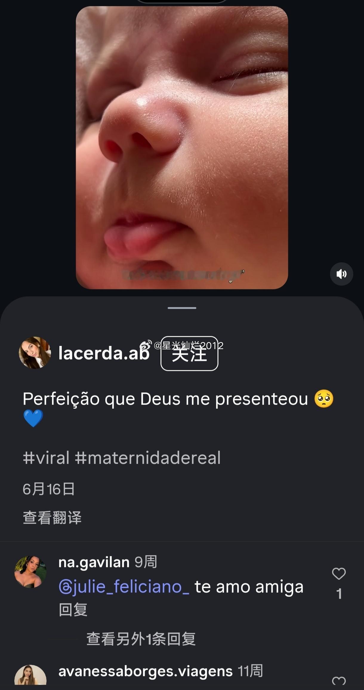 我来给古斯塔沃辟个谣，澄清一下。这张流传很广的图不是所谓古斯塔沃新出生孩子的图片