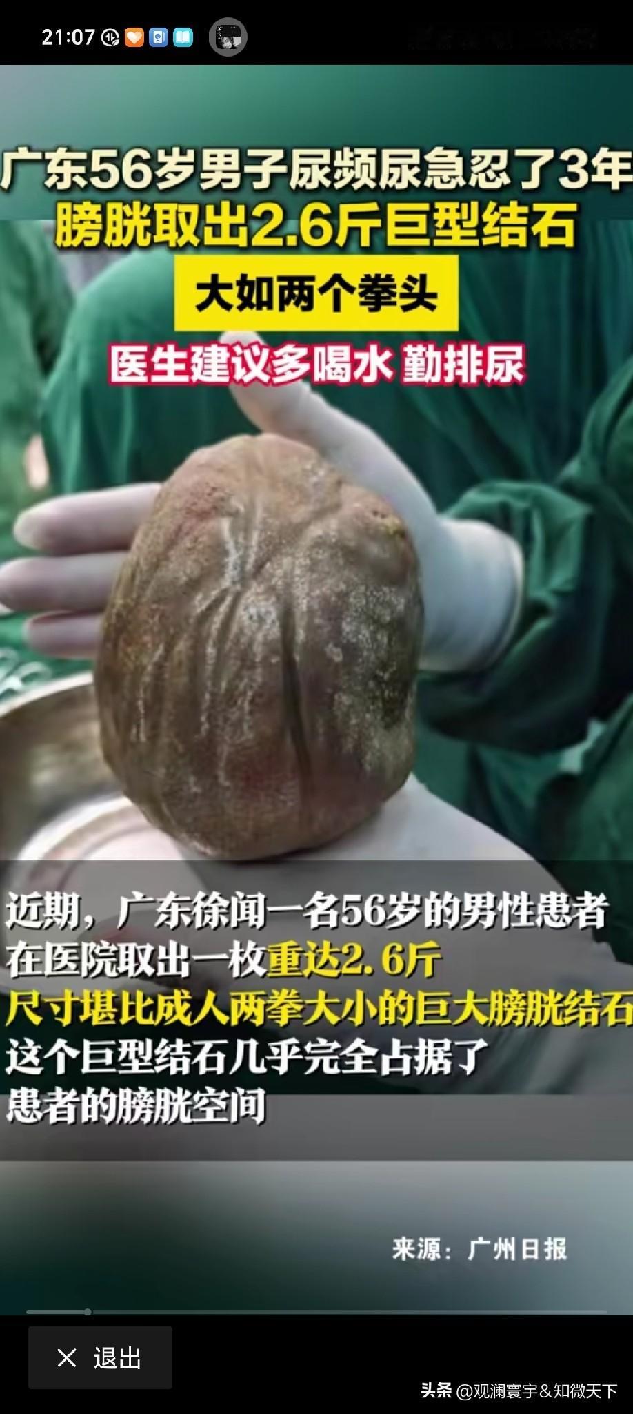 都修成“金丹”了[what]
这都能忍住痛？
[赞][赞][赞]