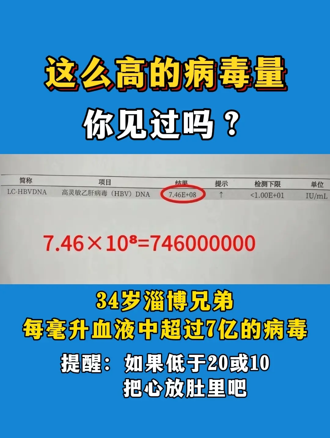 大家看这张检查单，这是半年前小伙子刚来就诊的时候，乙肝病毒载量7.46...