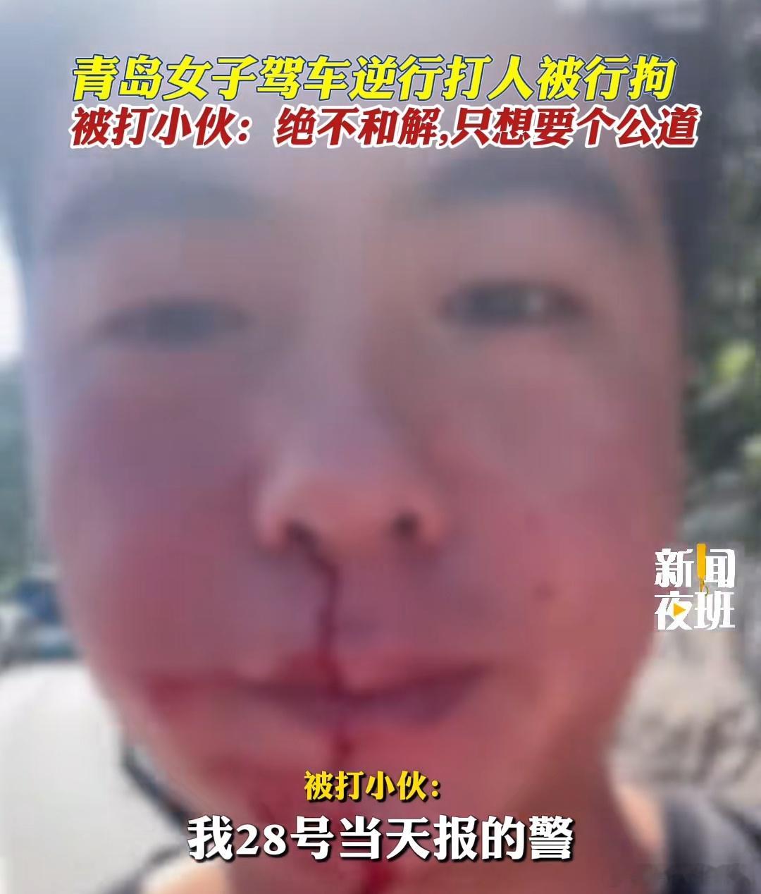 #青岛警方通报王某驾车逆行殴打他人案#说实话，给人家都打流血了，这处罚是不是太轻