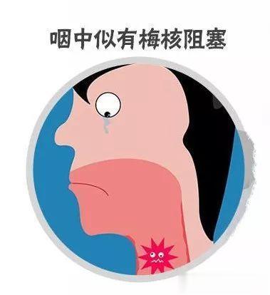 梅核气，就是咽喉异物感，妇人咽中如有炙肉。主要病机是痰气交阻，阻于咽喉，可以用半
