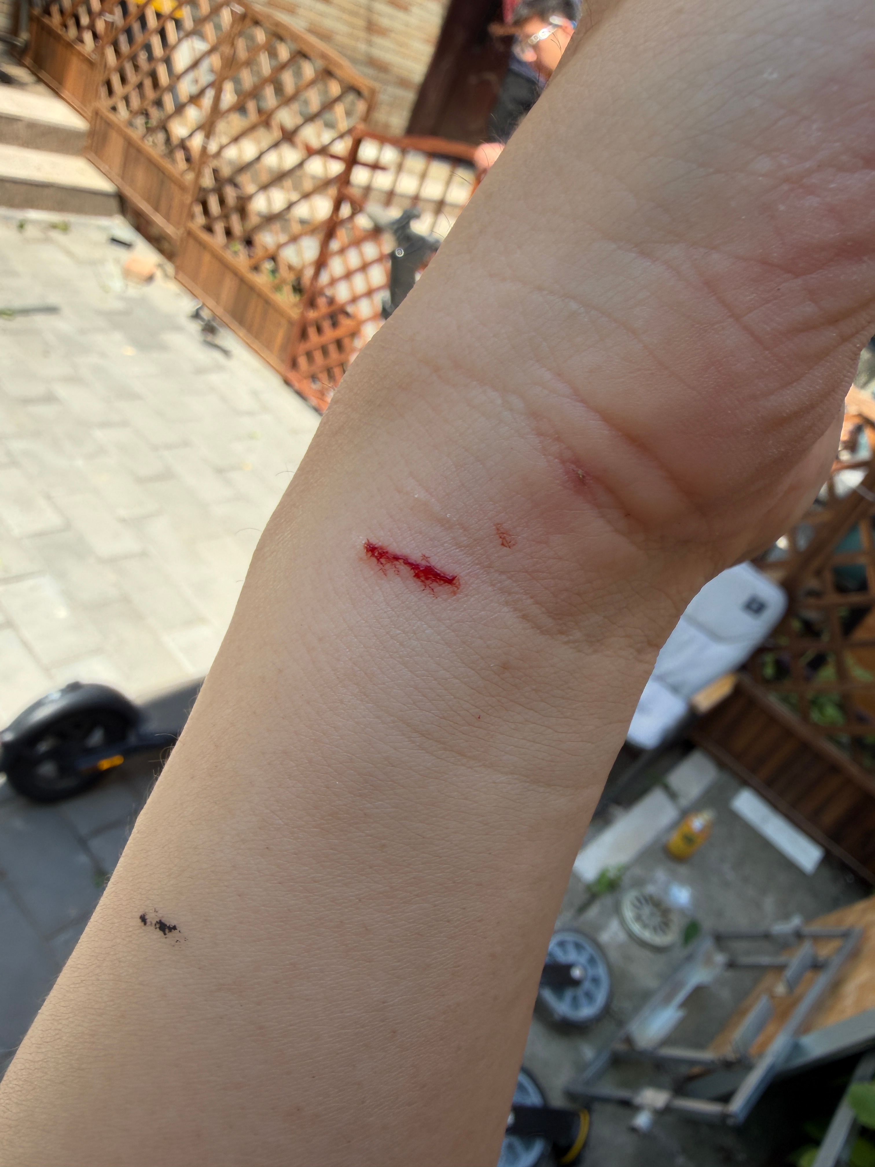 干点活感觉跟割腕了似的遍体鳞伤