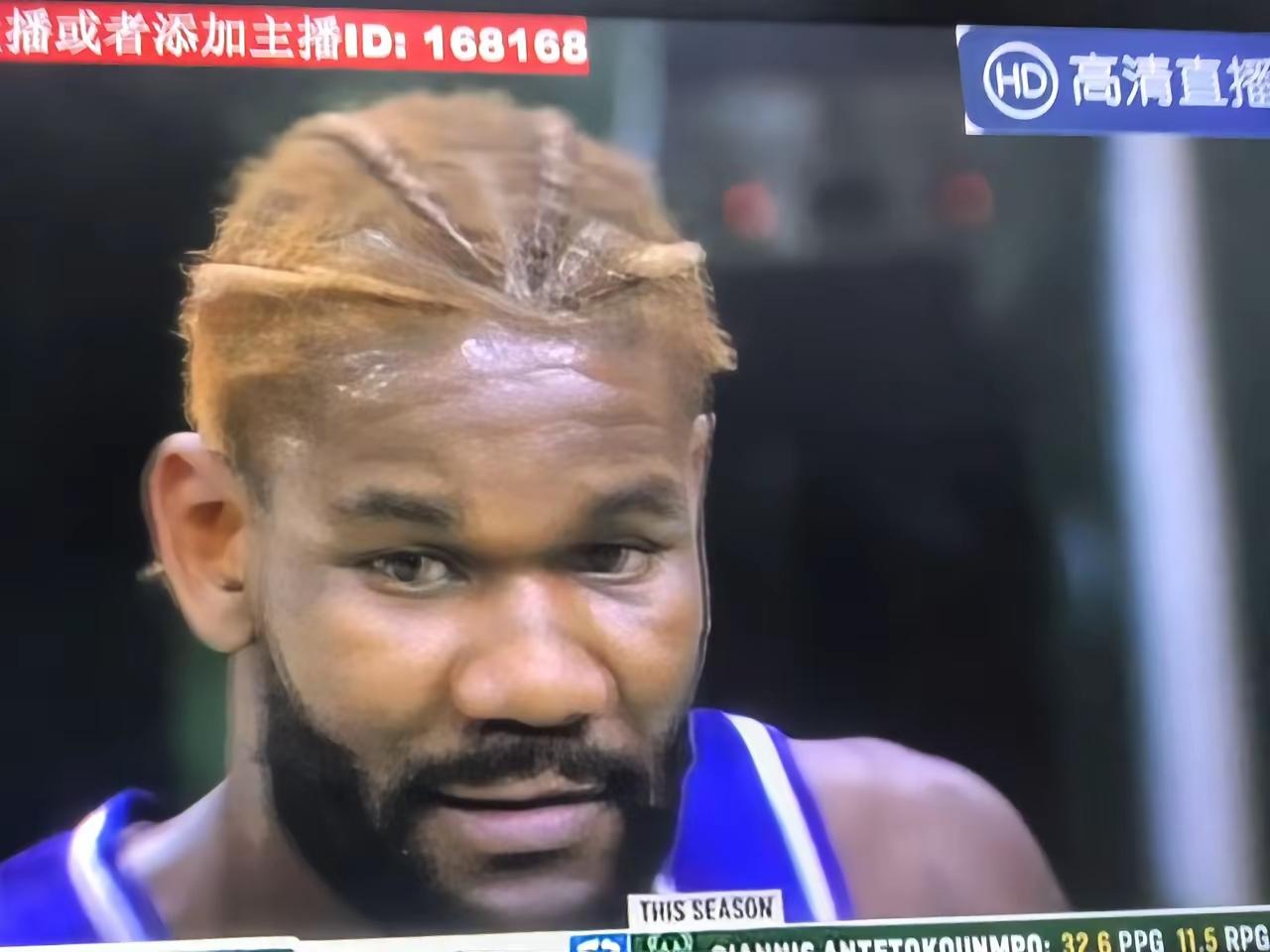 艾顿能力是有的，但在赛场上胆小，不敢与对手强硬对抗，当遇到高大威猛的对手就畏手畏