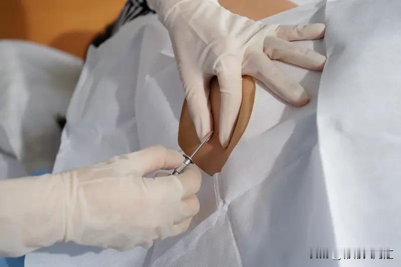 压疮形成后，处理方法得重视。一般治疗很关键，要定期给患者翻身，卧床患者每2小时翻