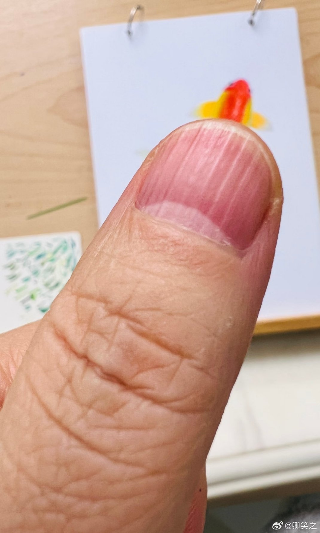 指甲上有竖纹真的是年纪大了导致的吗 