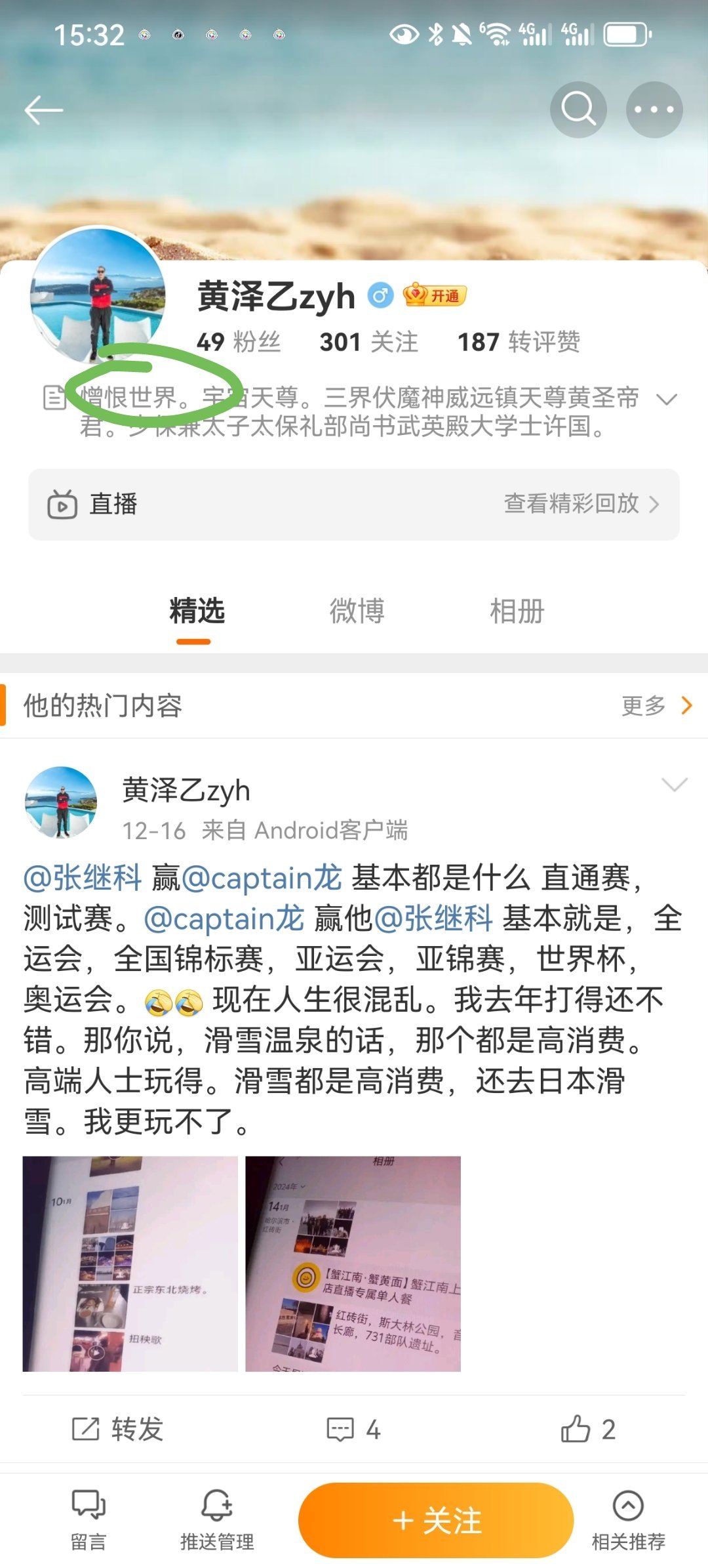 分享一个笑死人满嘴xnb的裹割 