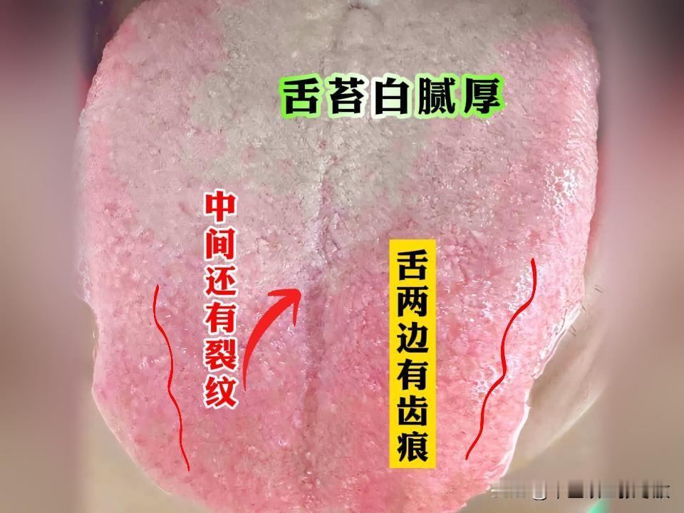 线上31岁大哥，年纪轻轻的房事出问题了，不是软就是快[发怒][发怒][发怒]
主