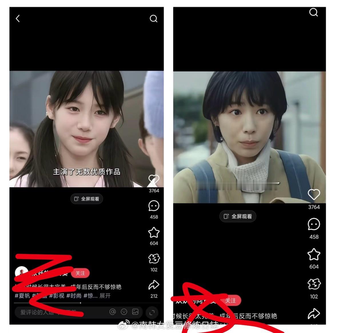 所以说整牙要趁早。年轻时候微凸老了只会越来越凸 （口周肌肉紧张 面部胶原蛋白流失