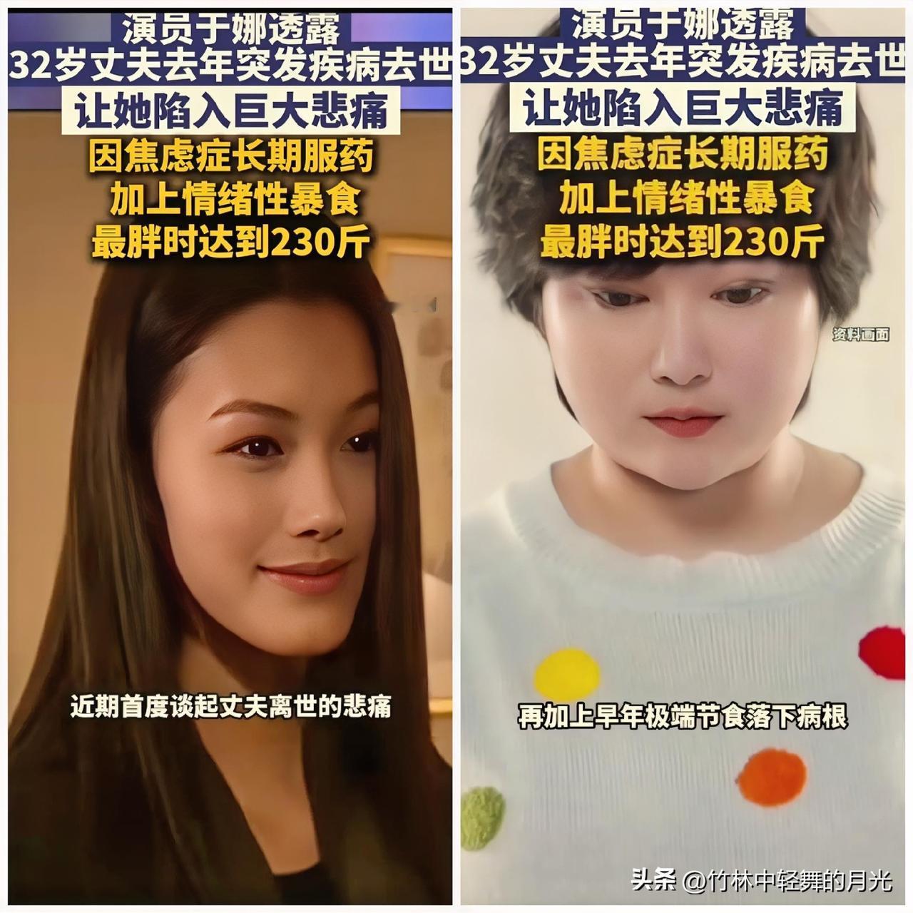 从纤细佳人短时间涨到230斤！于娜的身材巨变，当你知道真相，真的是感慨世事无常
