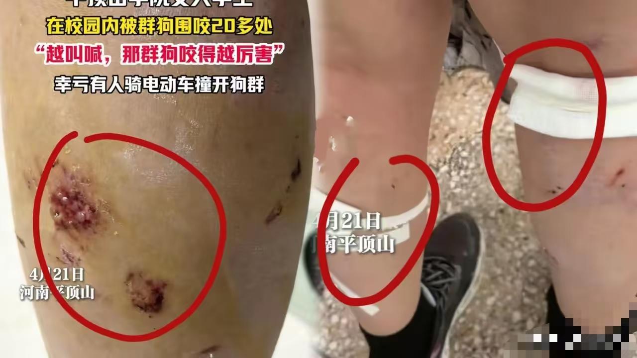 不知道这个女学生是不是当初的爱狗人士？我在美企上班，我们公司规定员工在公司被狗咬