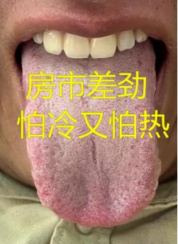 房市“快枪手”，时间快，敏感易泄，又怕热又怕冷，也不知道肾阳虚还是肾阴虚
 
患