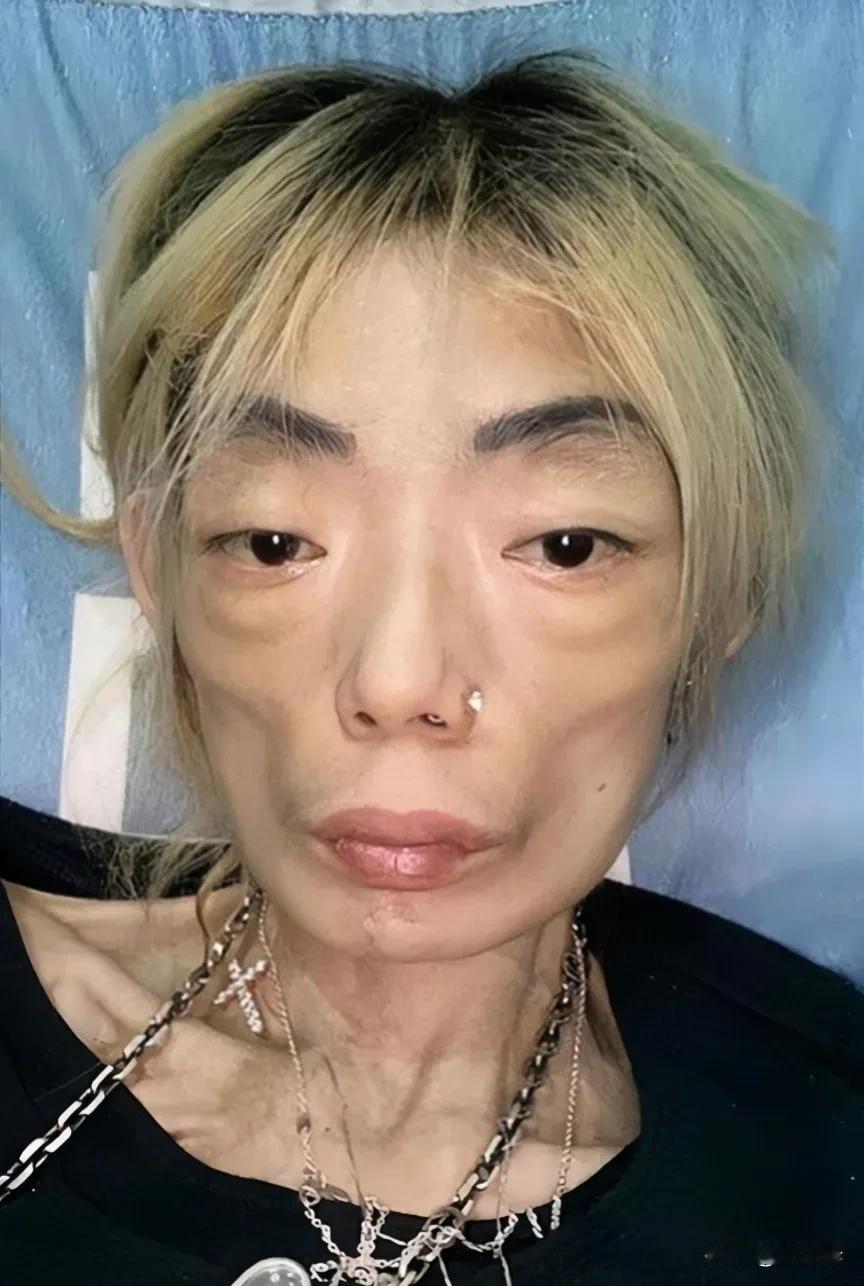2000年，超模伍智恒嫁给了富豪郭永淳，然而婚内8年，她竟然做了10余次肠胃切除
