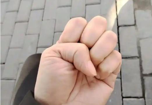 液病患者的调理方法，每天握拳一分钟，血指标越来越好！
随时随地都能做，不管你是哪
