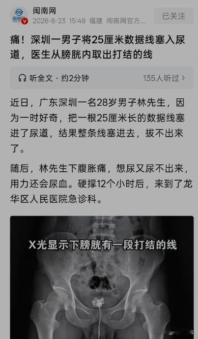 广东深圳，一男子由于一时好奇，竟然把一根25厘米长的数据线塞入尿道。结果进去容易