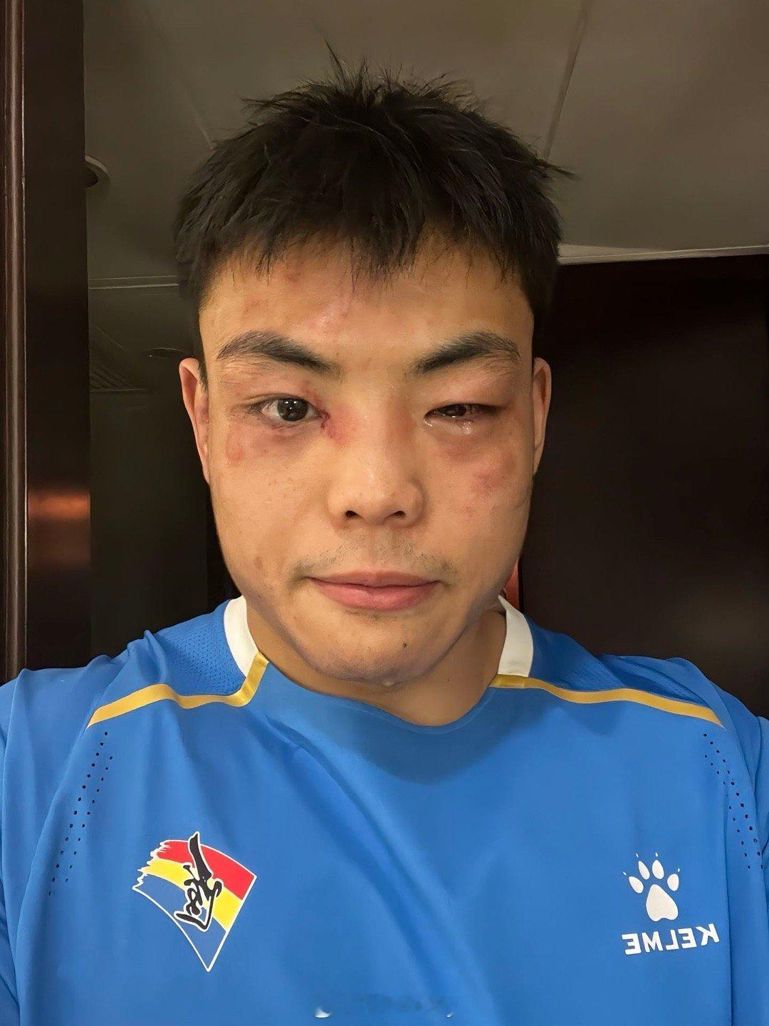 辽宁男子古典式摔跤金牌得主郑世昌…小伙子这太不容易了。