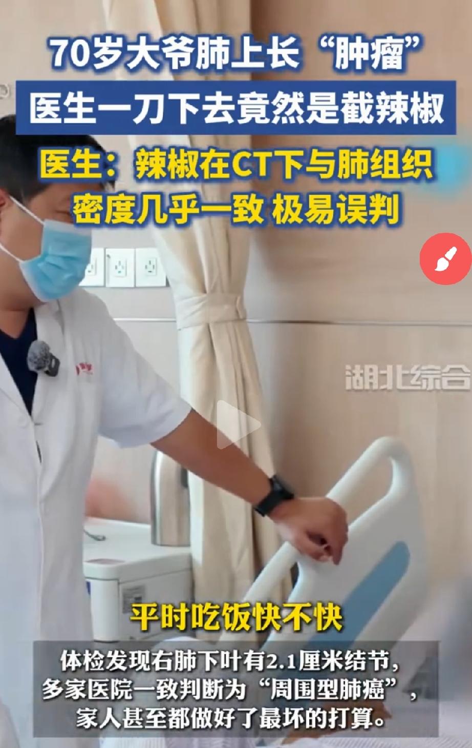 哭笑不得？西安，70岁的张大爷，体检查出肺里长了个2.1厘米的结节，CT显示带毛