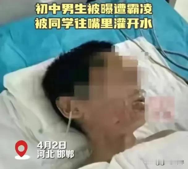 恐怖！邯郸再现霸凌事件，男生被多名同学嘴里灌开水！官方通报引争议：明明是故意伤害