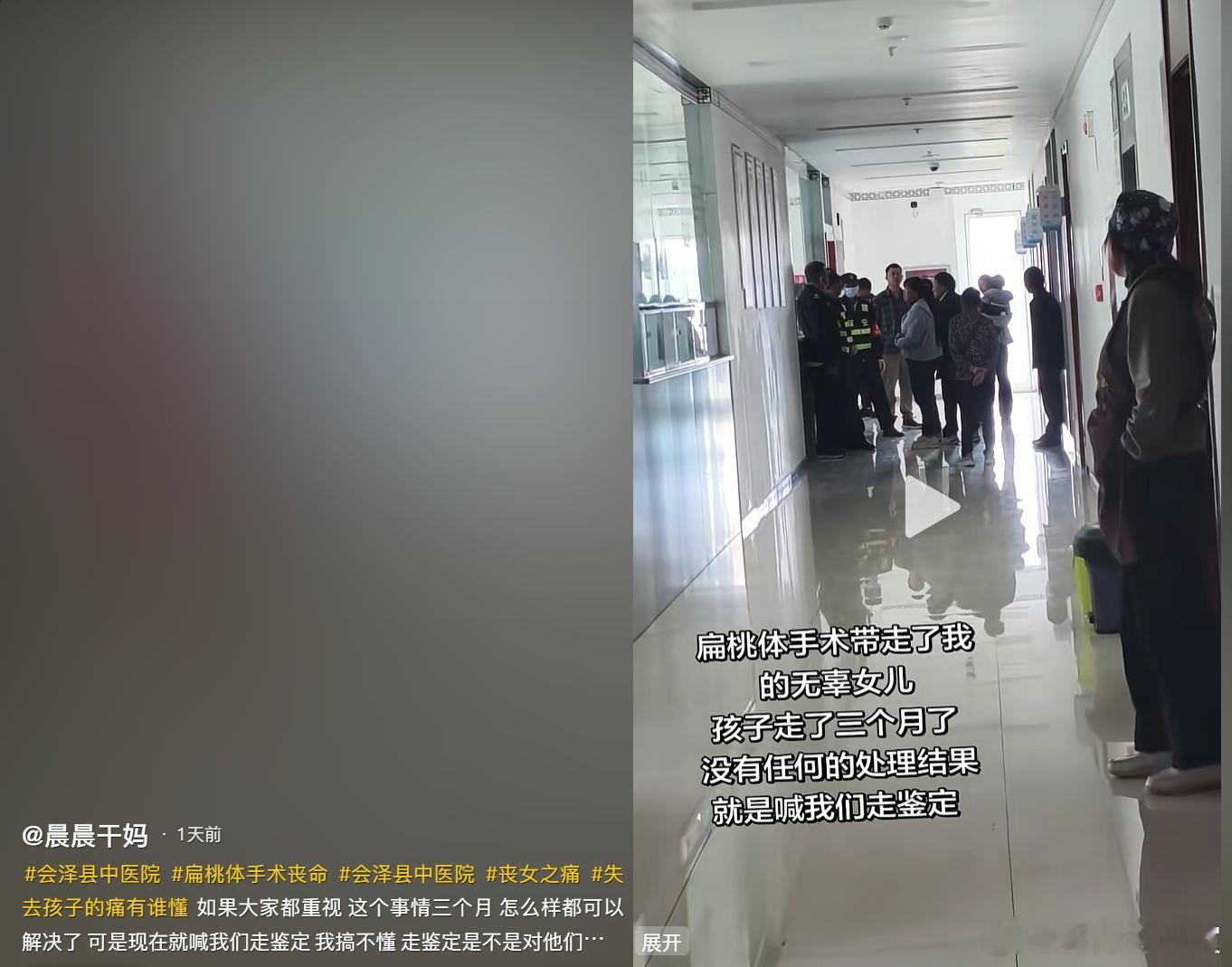 西医让你做手术，并不是治病，而是要钱，可能还要命。 