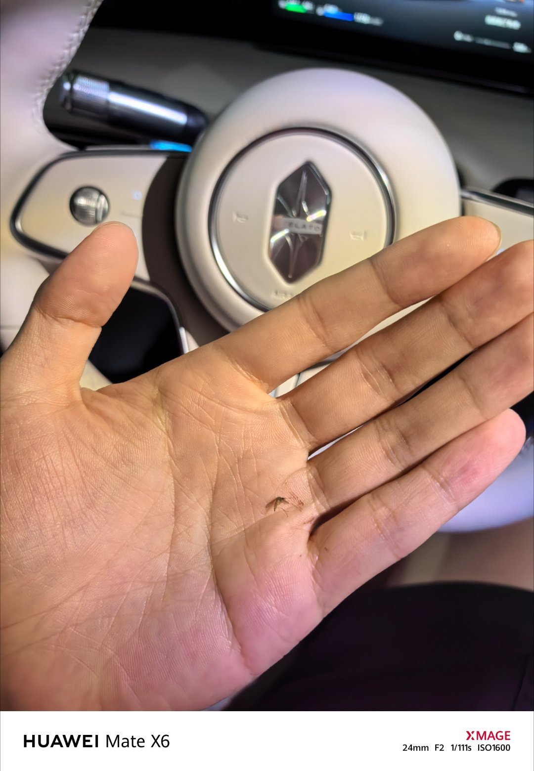 敢吃我的血那只能血债血偿了！[怒] ​​​