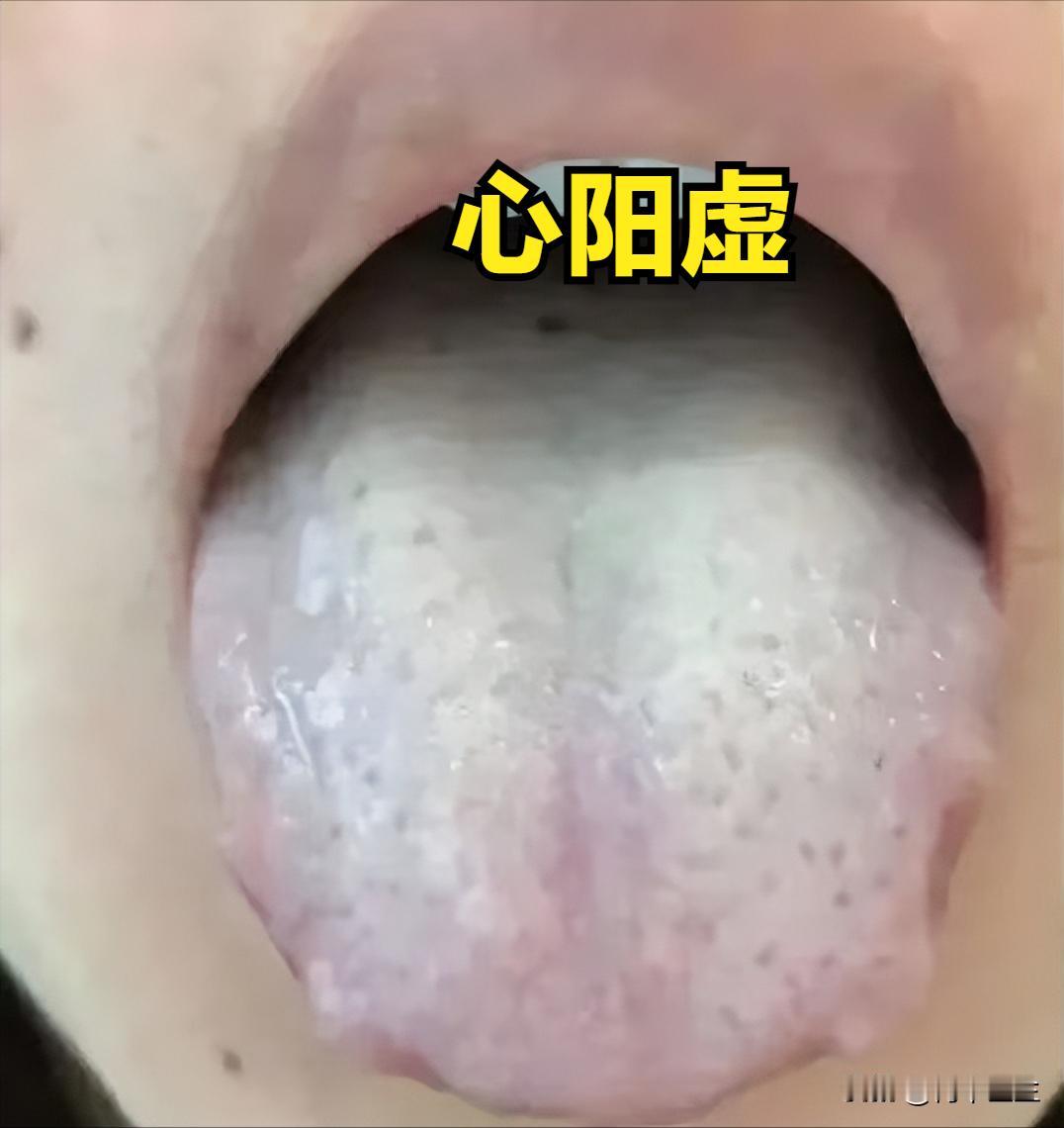 阳气足，百病无，这三个地方阳虚，就等于身体废了一半，今天何医生免费把补阳的经验教