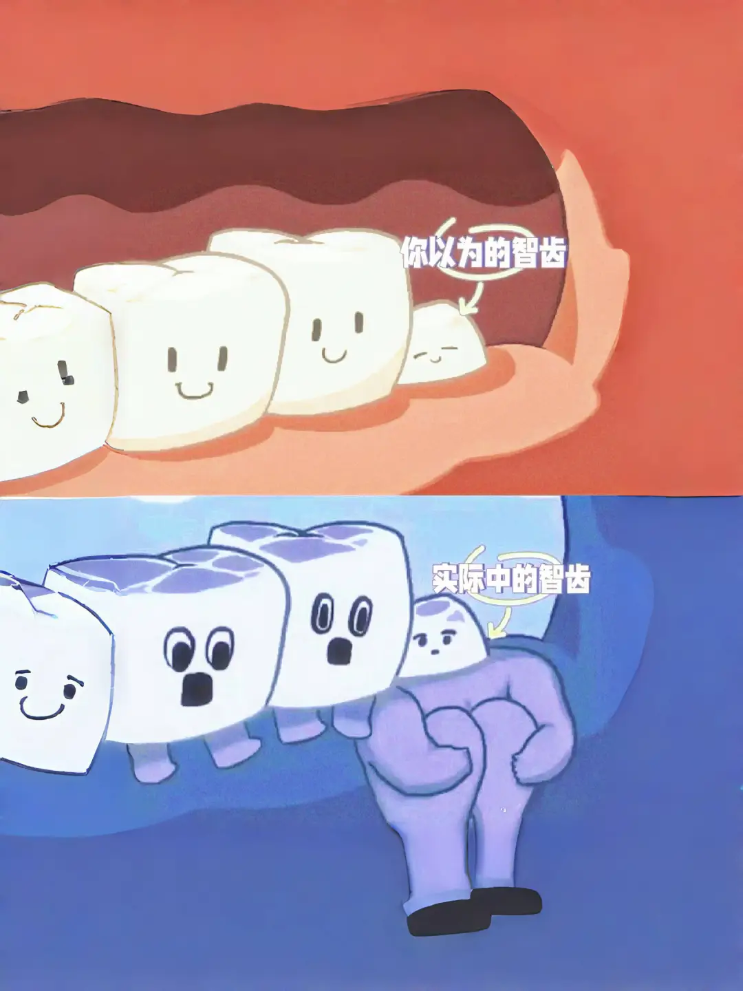 你以为的智齿VS实际上的智齿