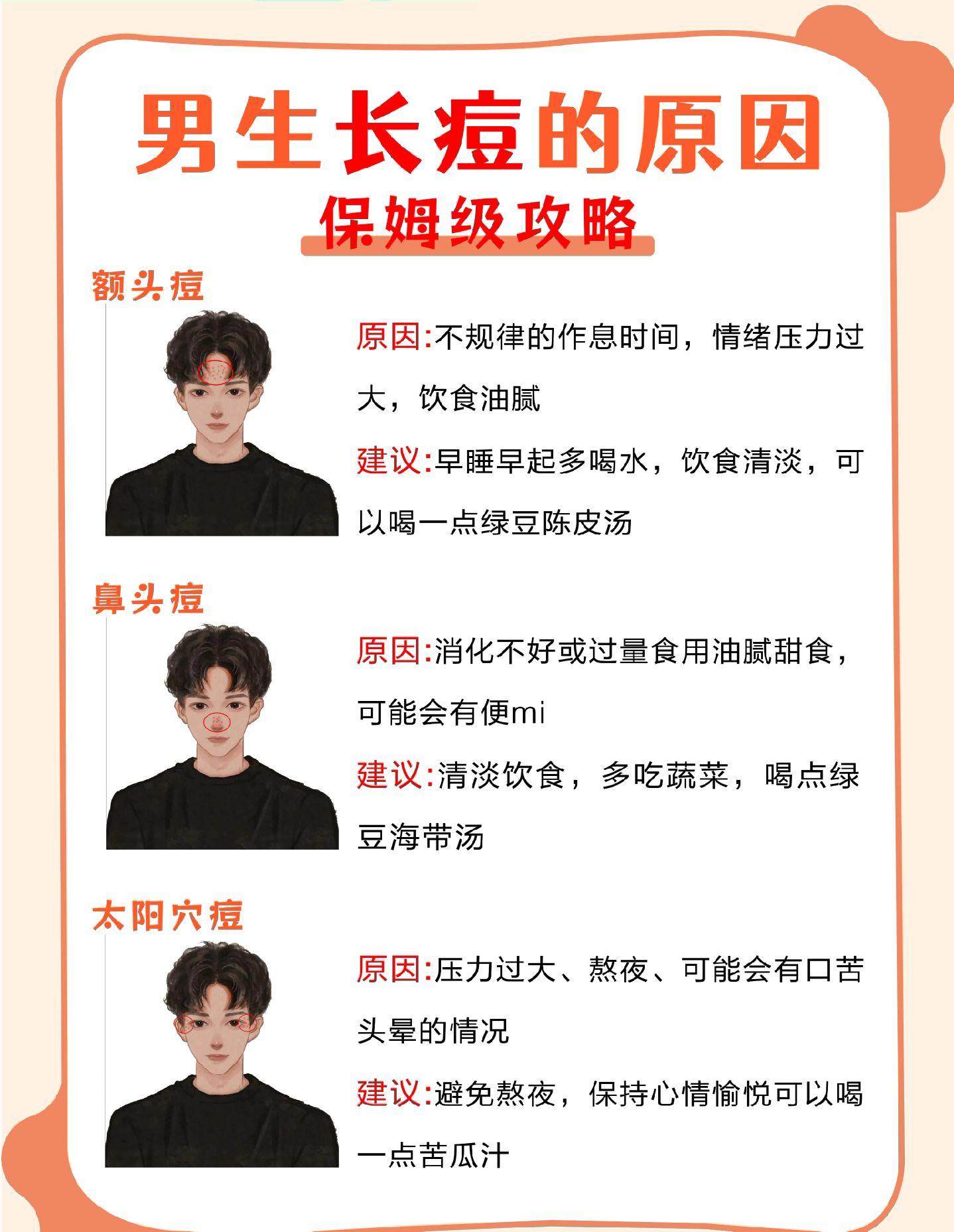 男生不同部位长痘的原因，你知道吗?男生长痘祛痘