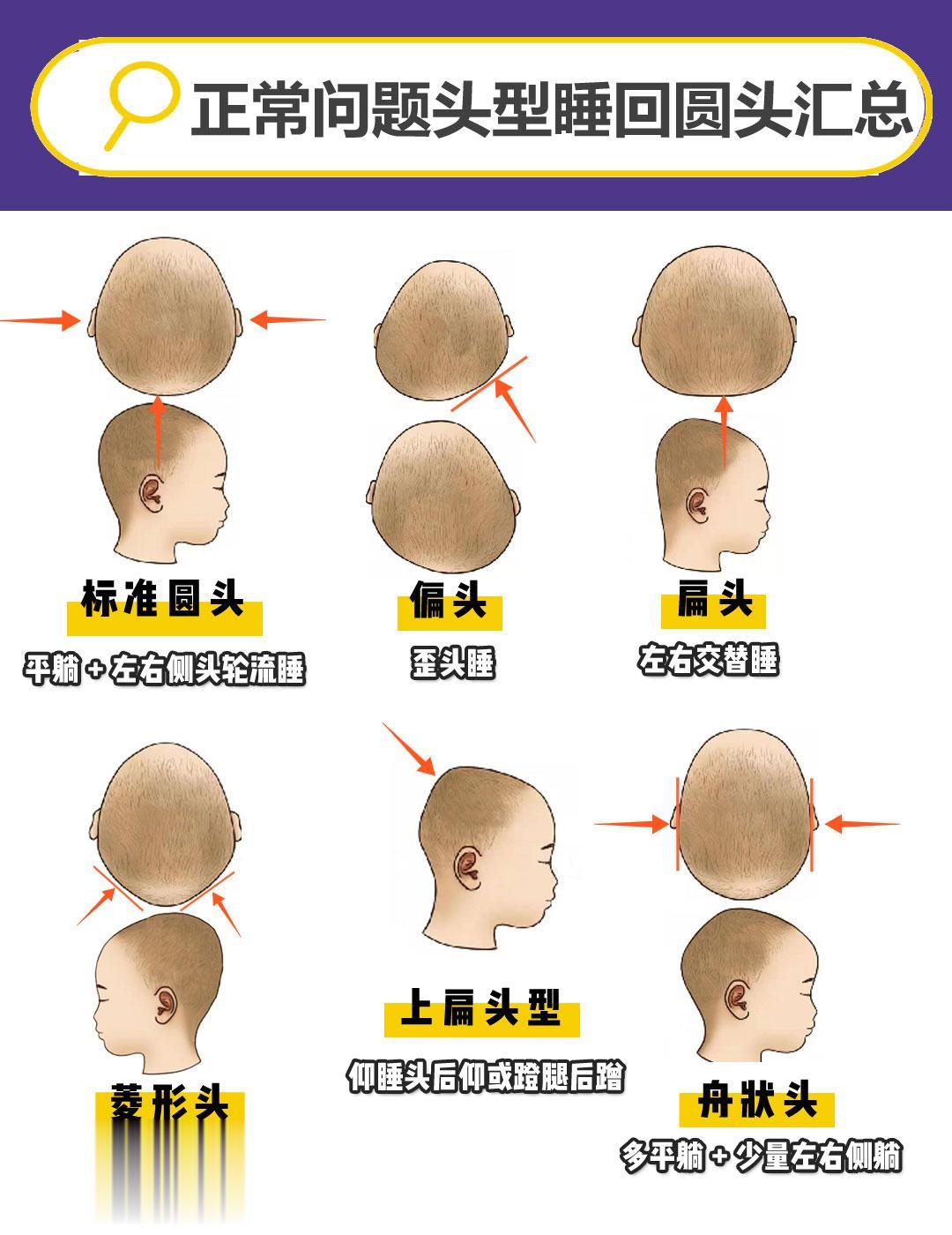 宝宝头型|手把手教你新生儿睡圆头。