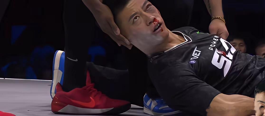 扇耳光大赛！ko总结出来！勇气非常可以佩服！但是我个人感觉第一他太轻敌了。以为外