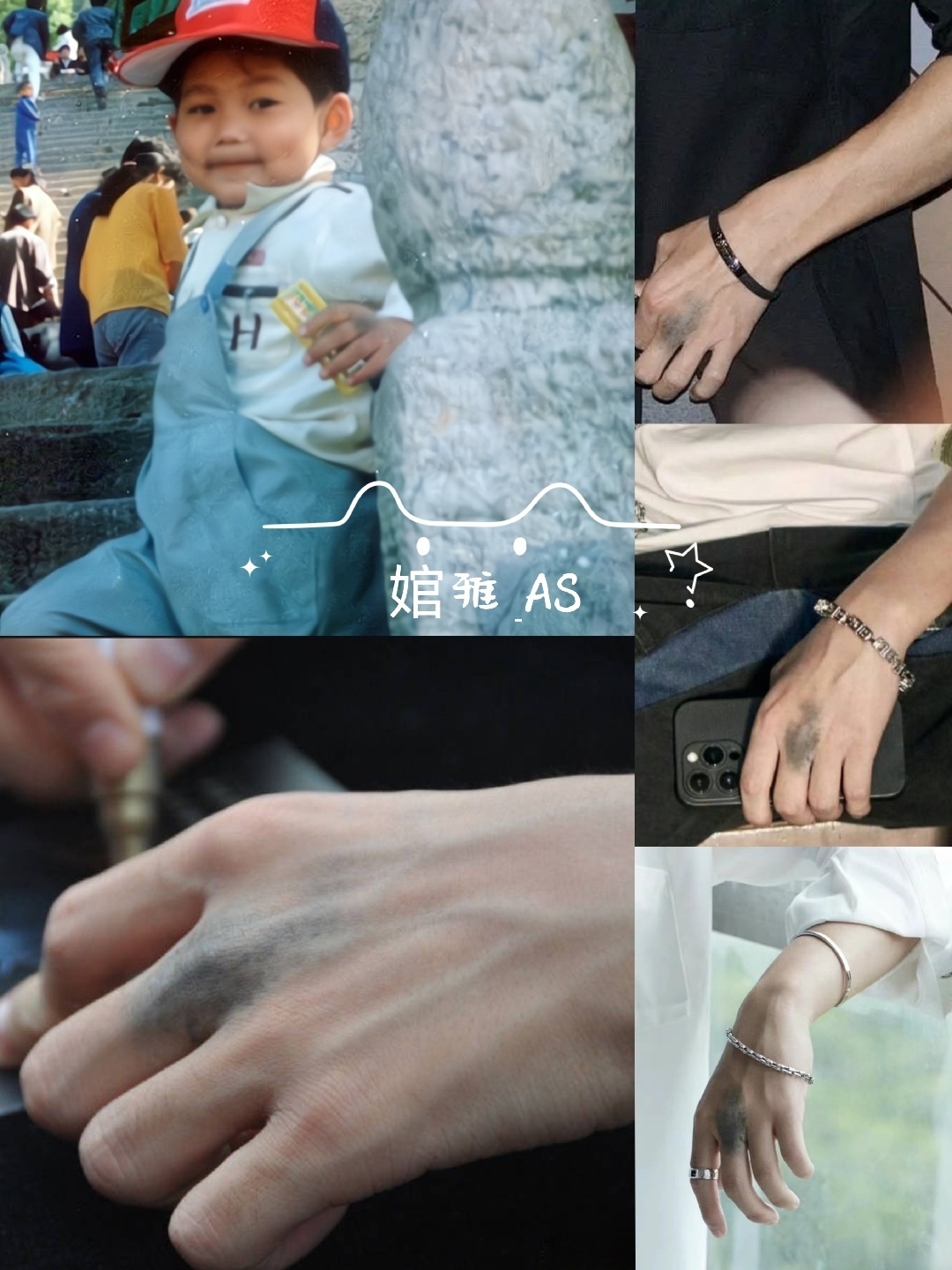 苏醒手怎么了哈哈哈哈哈哈哈哈哈哈哈哈，是胖胖的胎记！ 