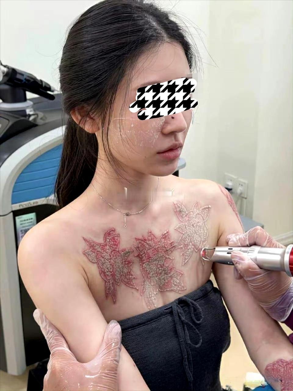 看着都痛，这是何苦呢？ ​​​