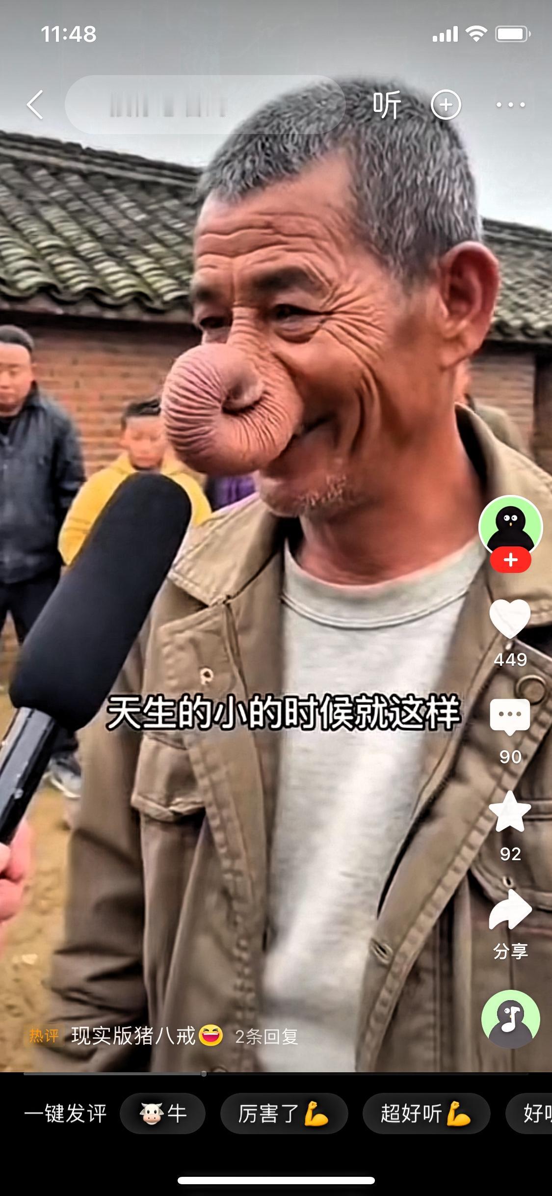 这鼻子一出来，我手机都差点拿不稳！
你见过长着大象同款长鼻的人吗？
采访镜头怼过