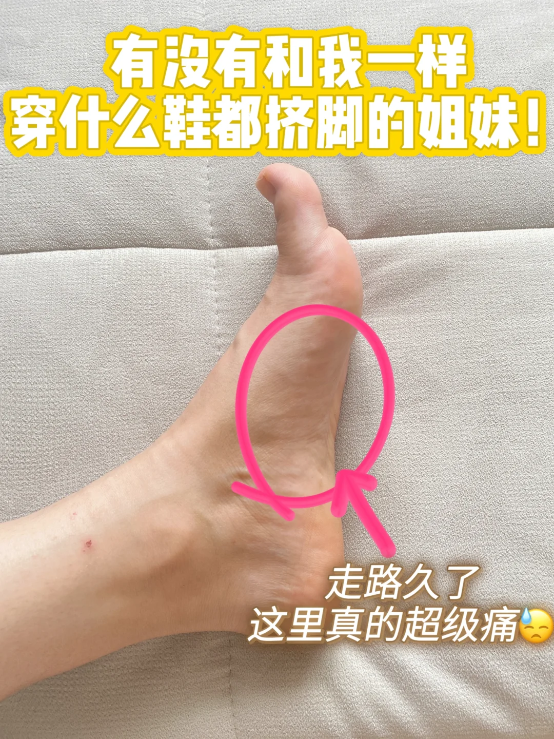 有跟我一样穿什么鞋都挤脚的姐妹吗？？