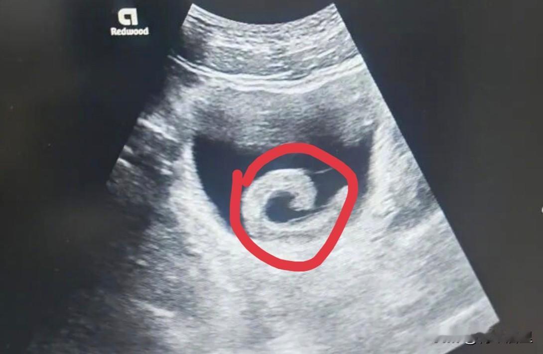 刷到大河报的一个新闻，令人震惊到难以言喻。一个23岁的小伙，轻信网上一些未经证实