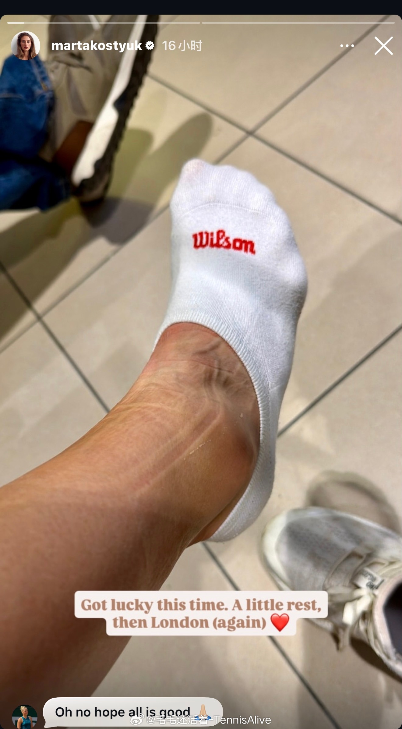 科斯秋克崴脚，恐影响草地赛季。 