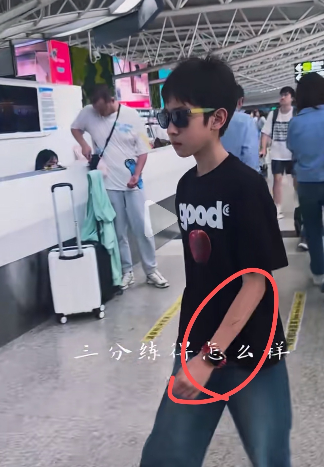 老师 我们家孩子胳膊上怎么这么大口子