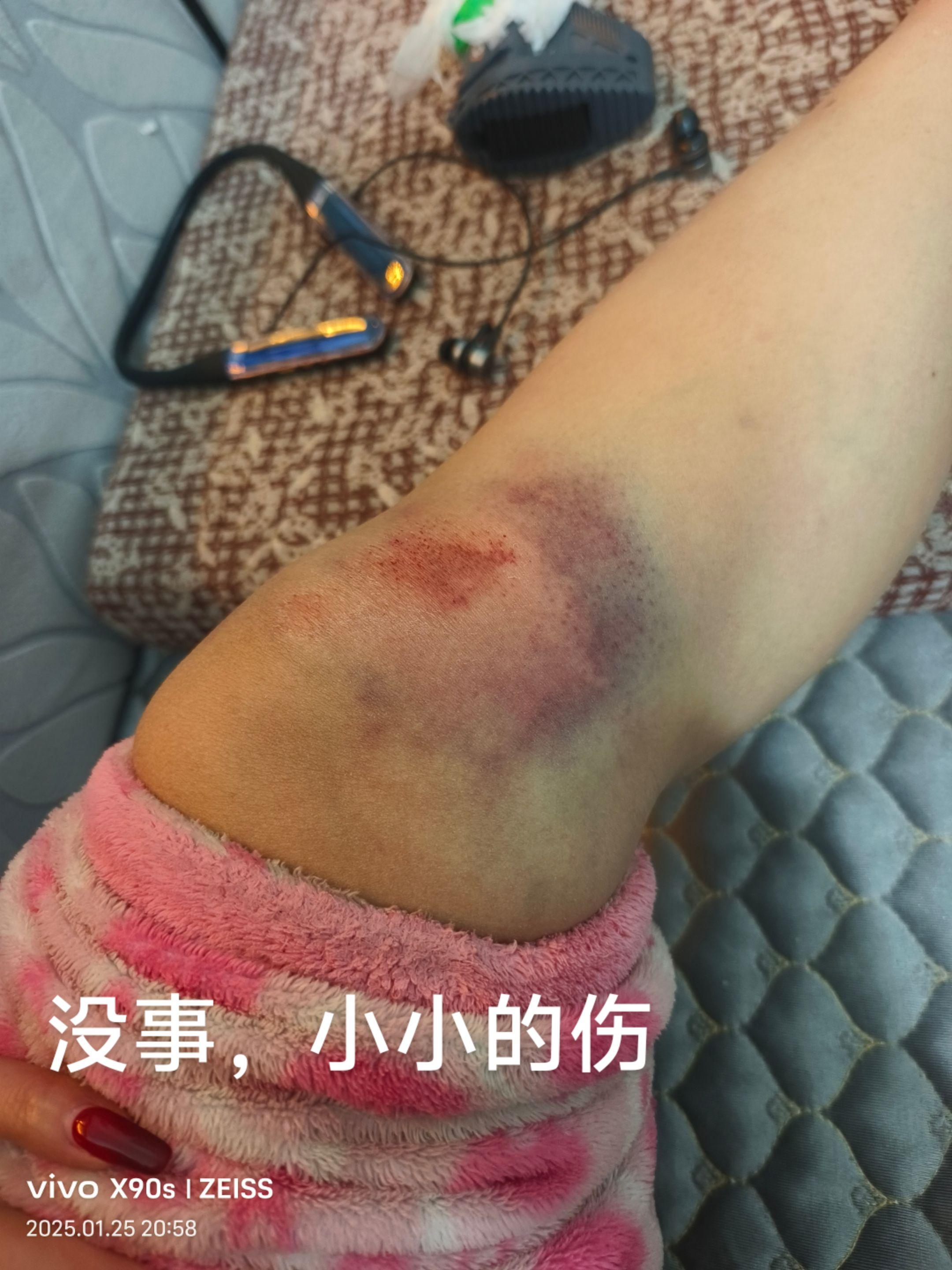 鬼知道我经历了什么 说不出的心酸 心里好难过 我好累好累 有一种疼叫做看着都疼