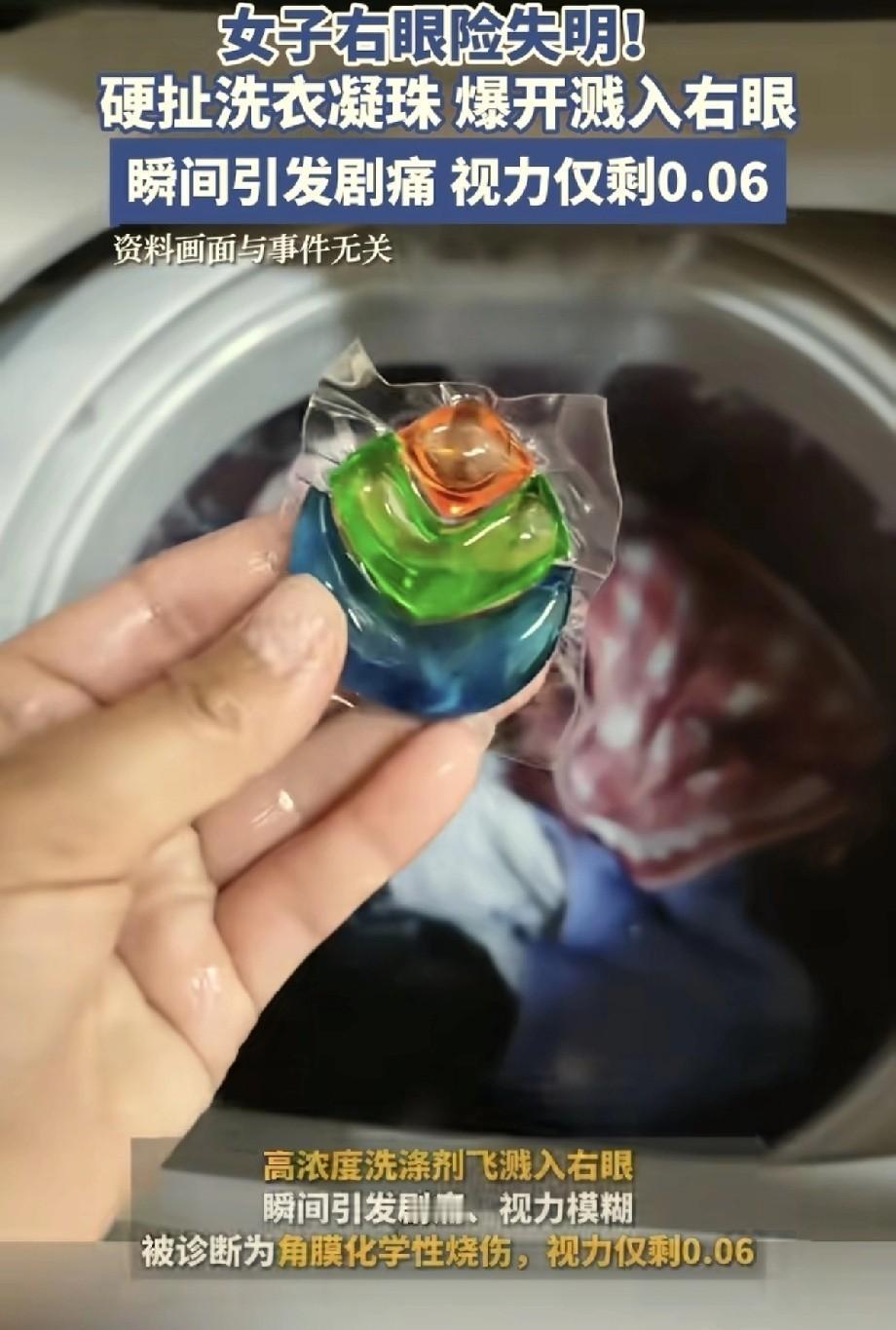 一位浙江妇女在洗衣服时发现几颗洗衣凝珠粘在一起，她想用手把它们分开。谁知薄膜一破