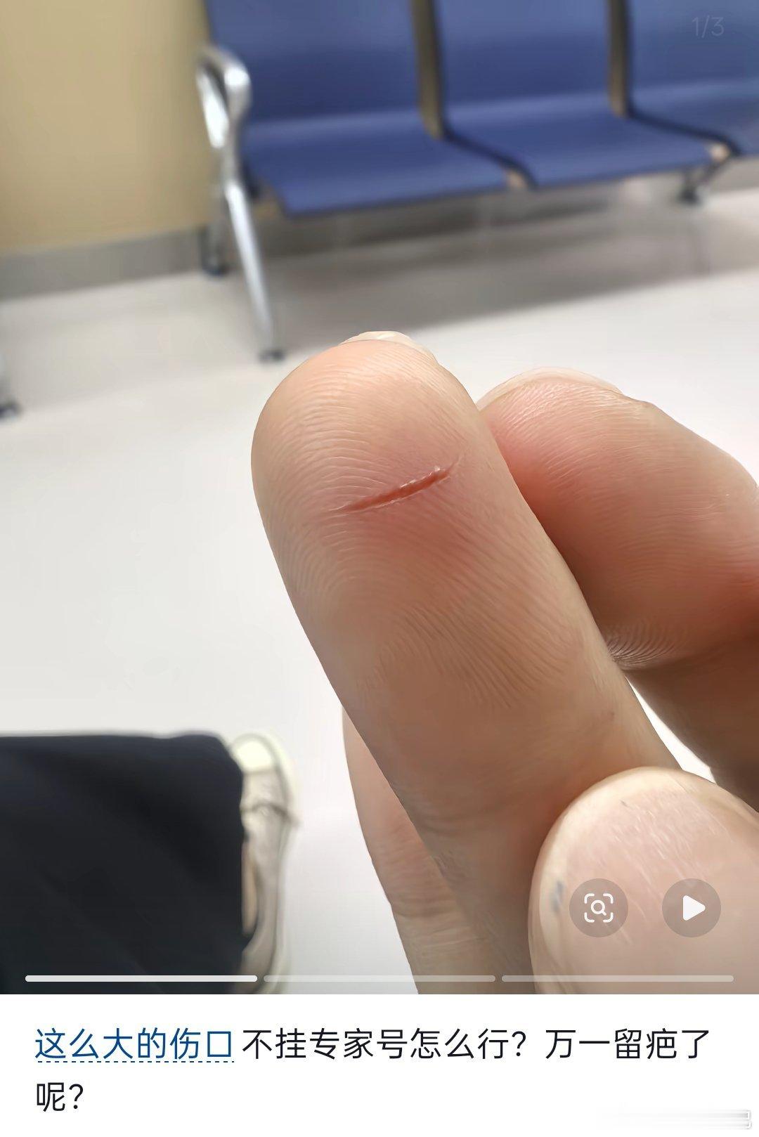医生说：得亏你来得早，来的及时，再晚来一步伤口就愈合了 