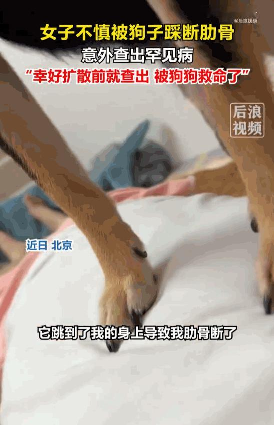 曲线救国！北京，一名女子在家中遭遇意外，被自己朝夕相伴的爱犬狠狠砸伤，数根肋骨当