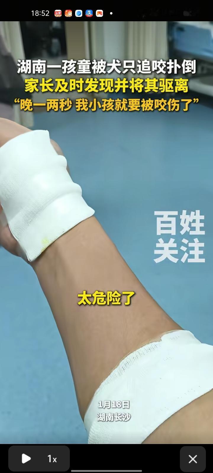 1月18日，长沙浏阳市。小孩被狗子追咬扑倒，幸亏家长及时发现并将其车里。视频显示