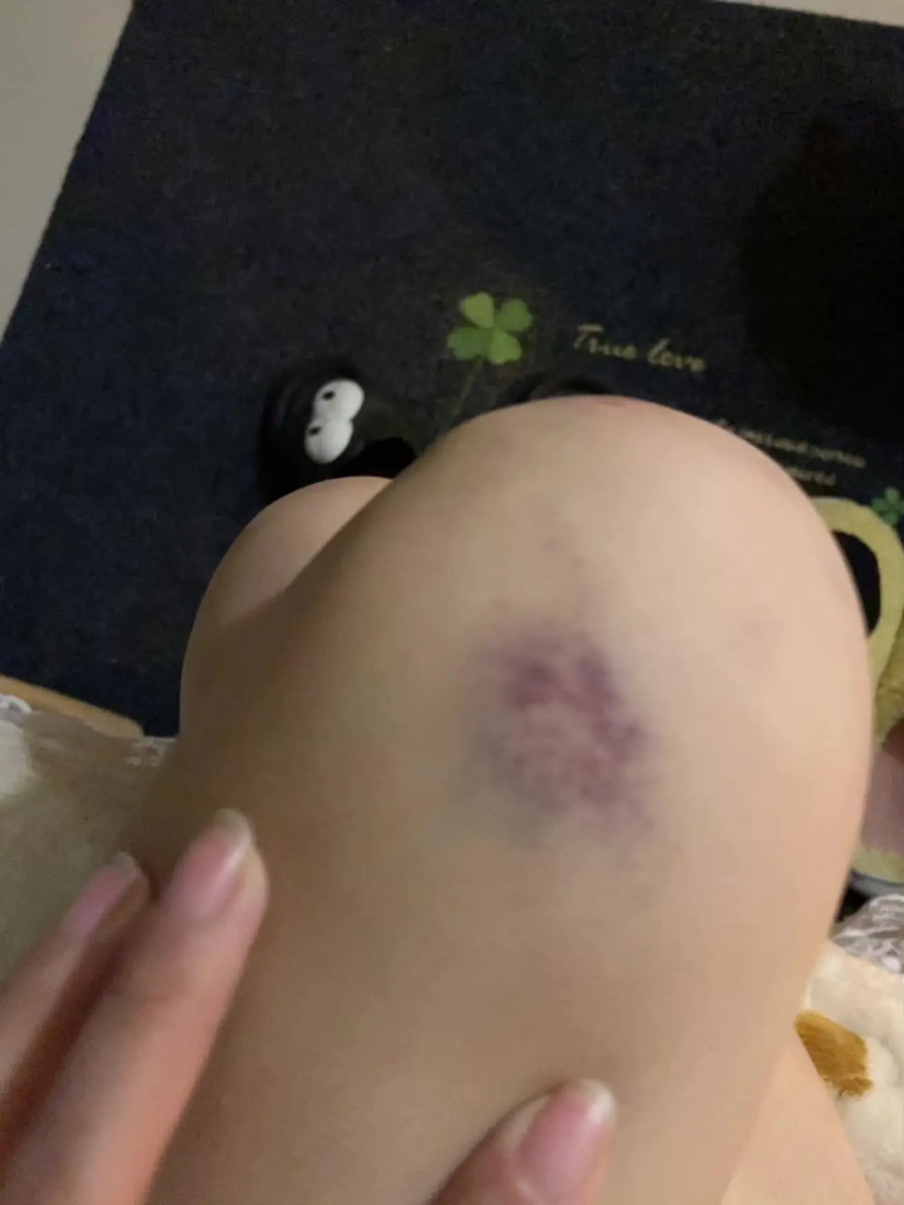 拍个视频代价太大了，侄子是亲侄子，啥也不能说。只怪自己太脆弱，认了。等...