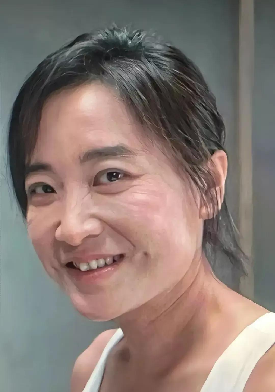 贾玲3个月瘦了100斤。暴瘦的后果就是皮肤松弛，脸上显了皱纹。身上看着还好，有腹