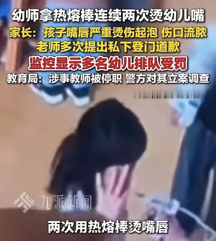 江苏徐州一幼师用热熔胶枪烫伤幼儿嘴唇，官方通报立案调查
 
据华商报大风新闻报道