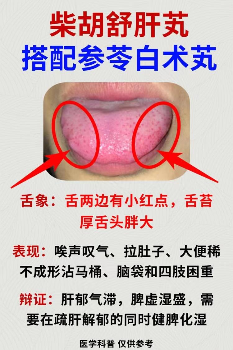 柴胡舒肝丸的7个搭档，可有化瘀血、消痰浊、调和肝脾、补足肝肾的作用
中医讲究辨证