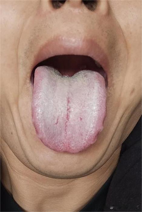 脾胃差，运化吸收能力差，身体就差，所以才会说脾虚百病生[机智][机智]
这位大哥