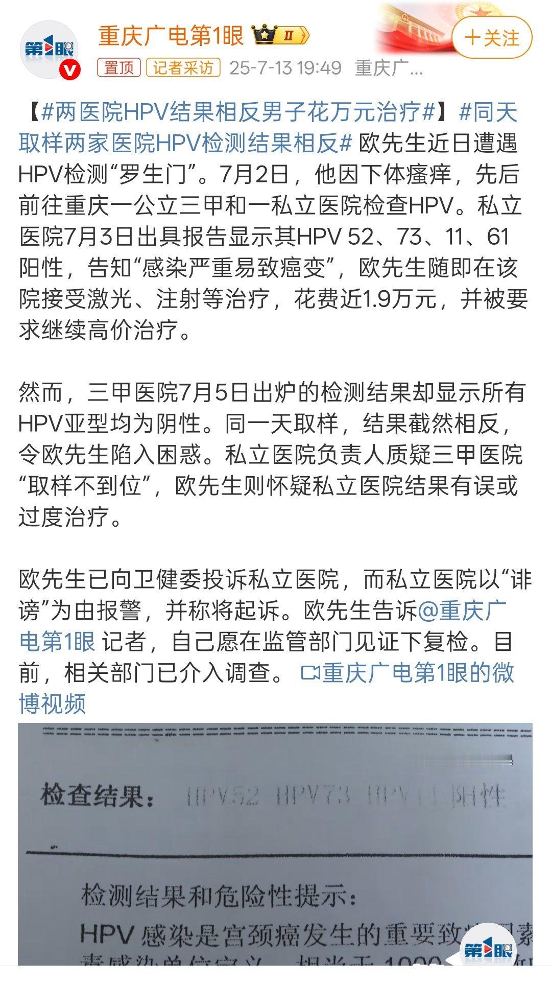两医院HPV结果相反男子花万元治疗不管是公立还是私立医院，概率性偏差可能偶尔都会